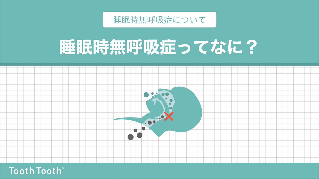 気道解析】01_睡眠時無呼吸症って何？｜歯科専門で唯一の